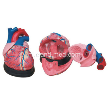 Medisch Jumbo-hartmodel